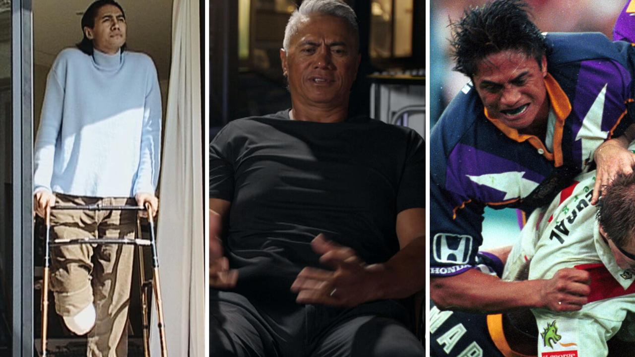 Tawera Nikau leg amputation story, Face 2 Face, Melbourne Storm, New Zealand, motorbike accident