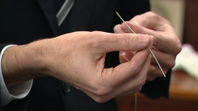 Electrodes are implanted into a patient’s brain to send small electrical pulses that alter the brain activity responsible for symptoms.