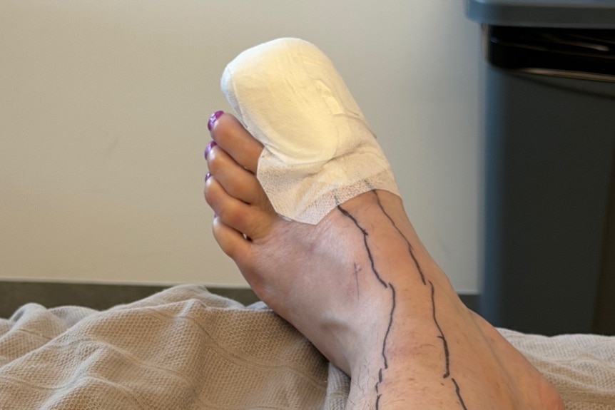 Foot with big toe covered in white bandage