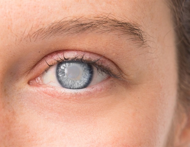 MMount Sinai ophthalmologist unveils breakthrough ocular fluid monitoring tool