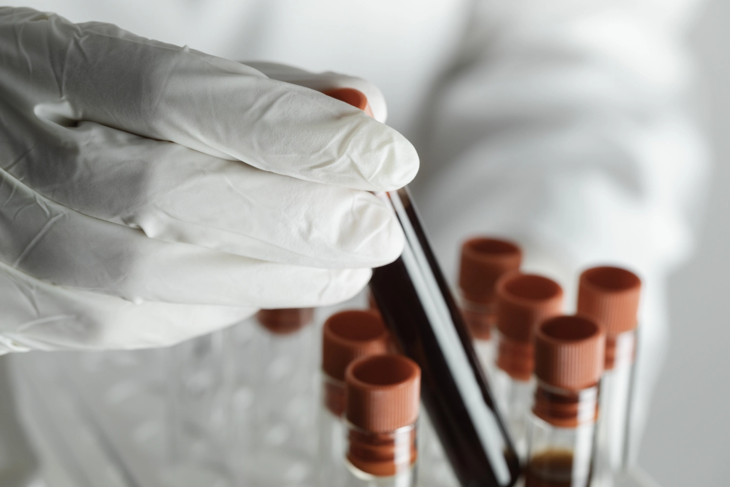 Anaemia Linked To Increased Cancer Risk