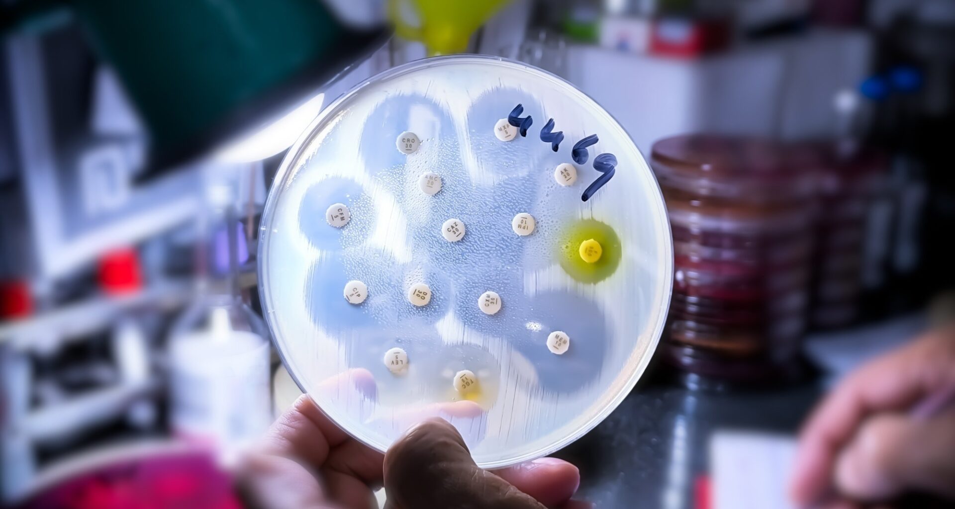 Antimicrobial susceptibility testing in petri dish. Image Credit: Saiful52 / Shutterstock