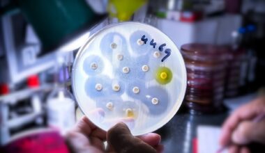 Antimicrobial susceptibility testing in petri dish. Image Credit: Saiful52 / Shutterstock