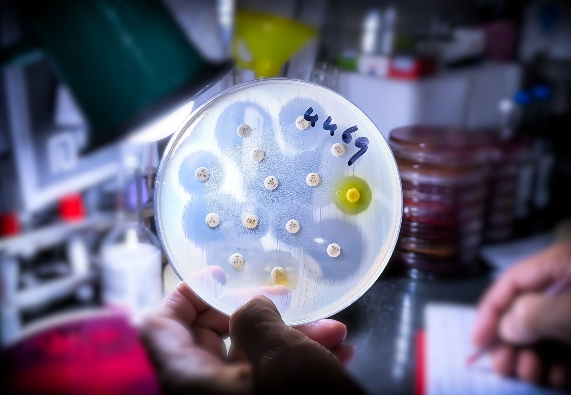 Antimicrobial susceptibility testing in petri dish. Image Credit: Saiful52 / Shutterstock