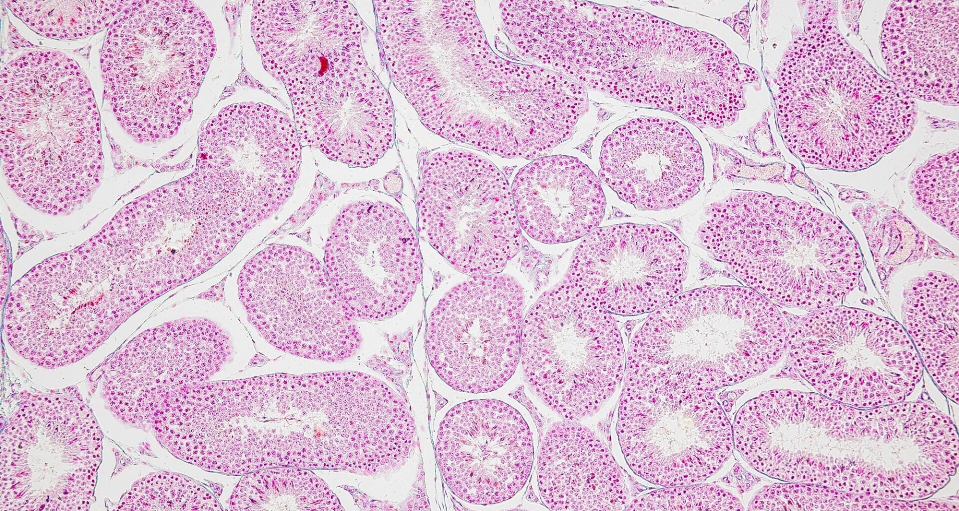 Backgrounds of Characteristics Tissue of Ovary rabbit and Tissue of Testis mouse under microscope.