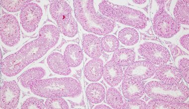 Backgrounds of Characteristics Tissue of Ovary rabbit and Tissue of Testis mouse under microscope.