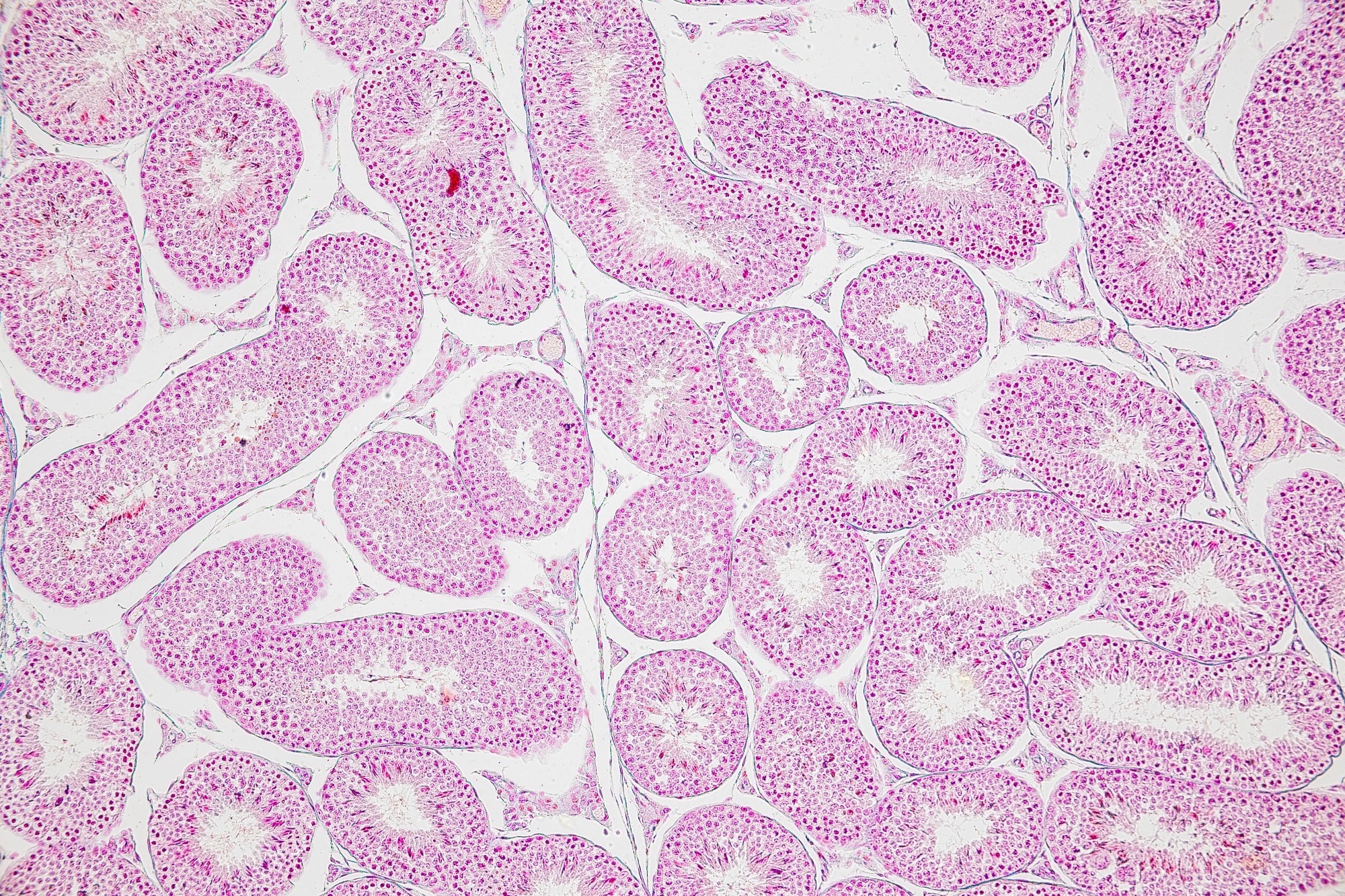 Backgrounds of Characteristics Tissue of Ovary rabbit and Tissue of Testis mouse under microscope.