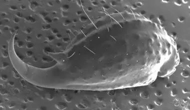 SE micrograph of the entire telson (stinger) of the Tanzanian red bark scorpion (Babycurus Jacksoni). Image includes the telson vesicle, in which the two venom producing glands can be found. Muscles surrounding the glands will contract internally, pushing venom up through conduits to the tip of the telson (termed the aculeus). This species also features a subaculear tubercle (small protrusion above the stinger) with an unknown function. Credit Sam Campbell/University of Queensland