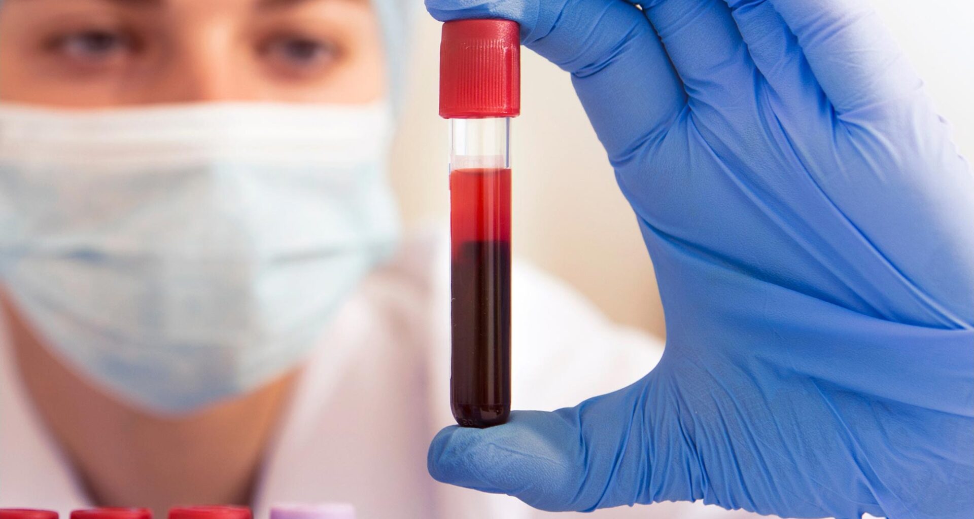 Medical Blood Test Tubes