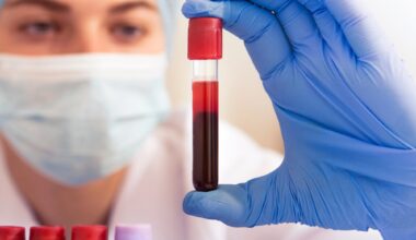 Medical Blood Test Tubes