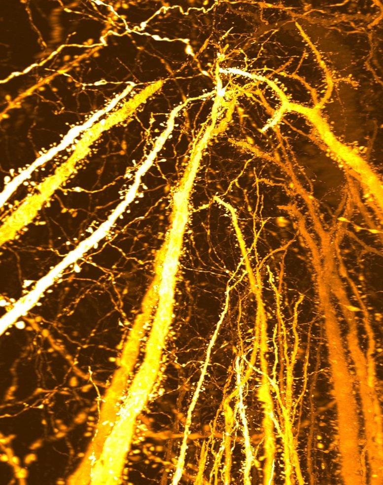 New Synaptic Formation Adolescent Brain