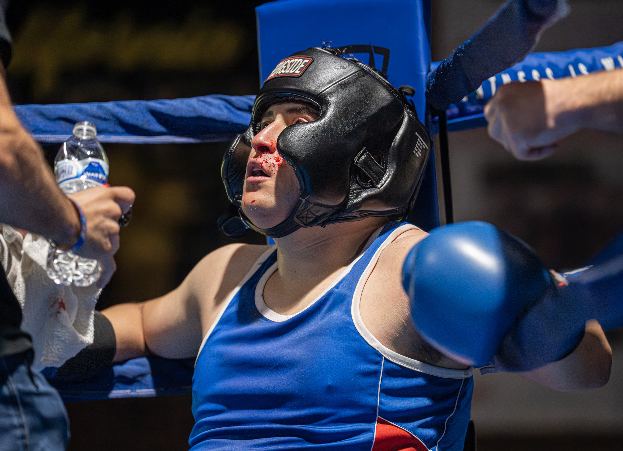 Omar Escobar receives medical attention during the second round of...