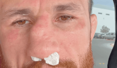 Merab Dvalishvili smashes nose in training, refusing surgery until retirement