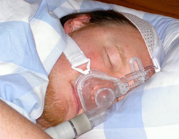 Sleep apnea more common in former football players than previously recognized