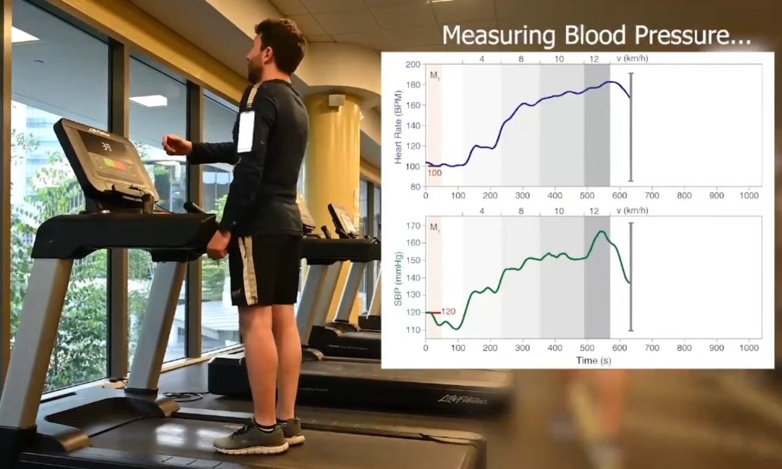 Blood pressure monitoring on the smart fabric developed by National University of Singapore's researchers