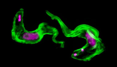 Scientists Solve 40-Year-Old Mystery of Sleeping Sickness Parasite : ScienceAlert