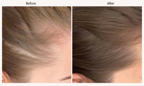 Before and after using the uklash product