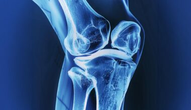 X-Ray Bones Knee Joint Wide