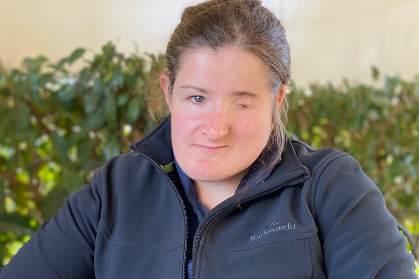 A dark-haired woman with facial difference wears a zipped-up jumper while sitting in front of a hedge.