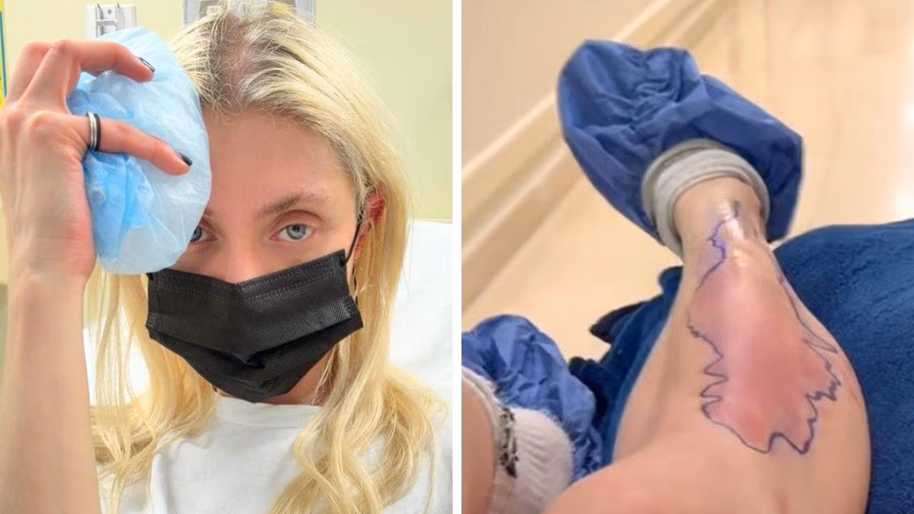 Taylor Momsen admitted to hospital after venomous spider bite