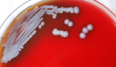 Thailand urges public caution as melioidosis cases climb