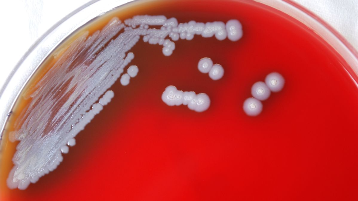 Thailand urges public caution as melioidosis cases climb