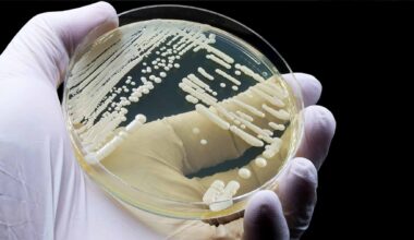 A microscopic visualization of the drug-resistant Candida auris fungus spreading.