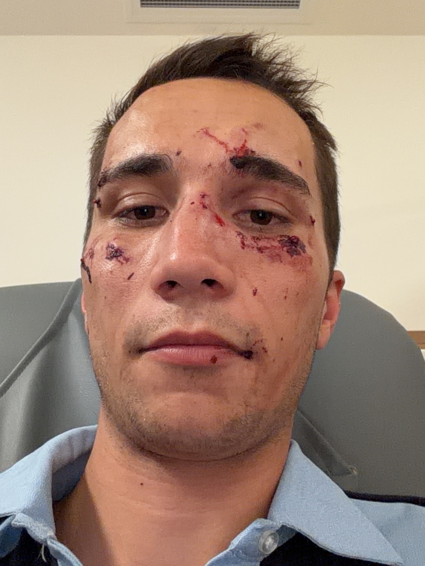 A police officer with cuts, blood and bruising around his eyes. 