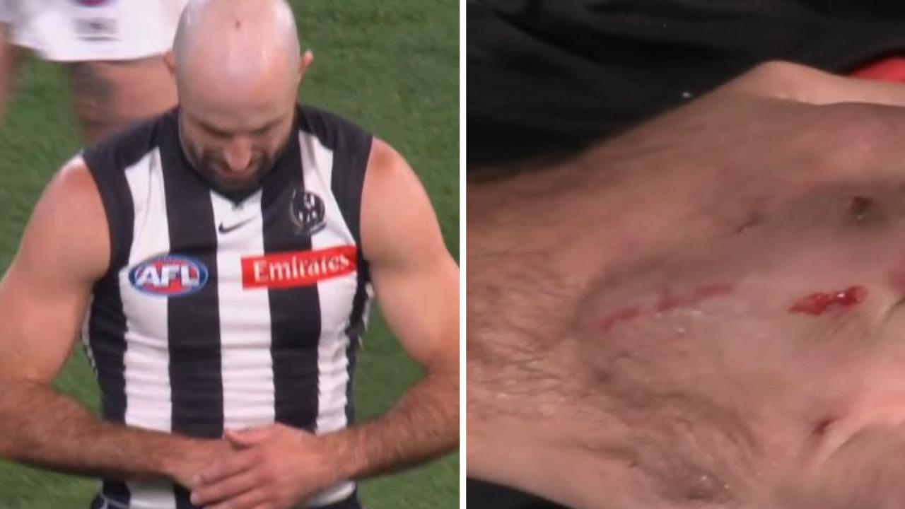 Live AFL 2026, Collingwood Magpies vs Hawthorn Hawks, Round 8