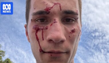 Police officer recovers from facial injuries as man who allegedly attacked him granted bail