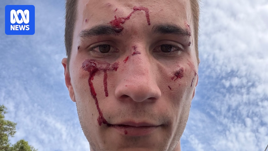 Police officer recovers from facial injuries as man who allegedly attacked him granted bail