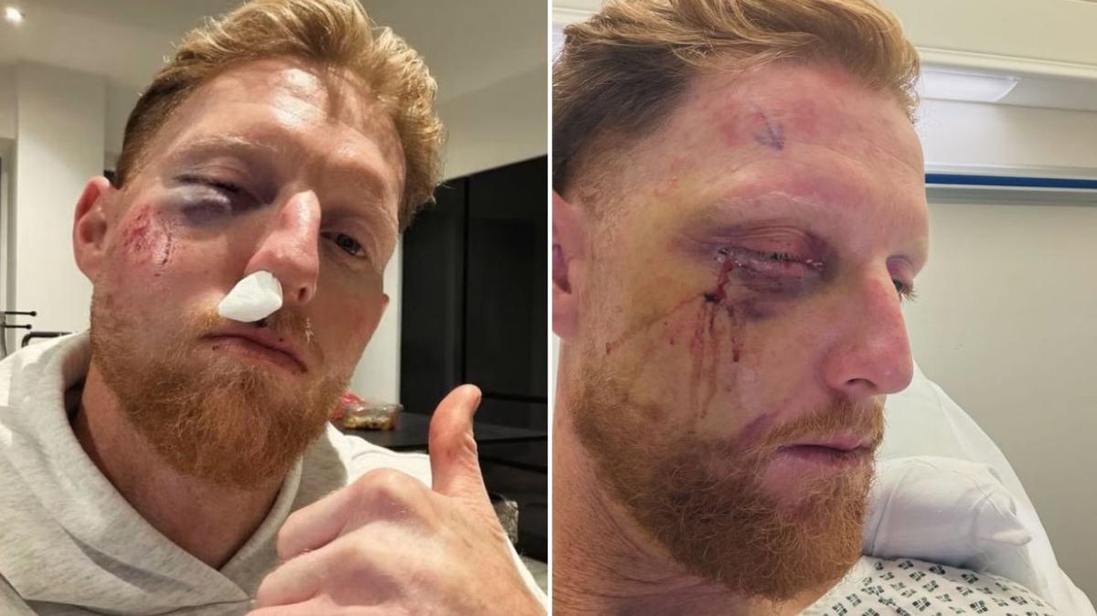 England Test captain Ben Stokes admits to serious fears after freak cricket accident: ‘Might not be here’