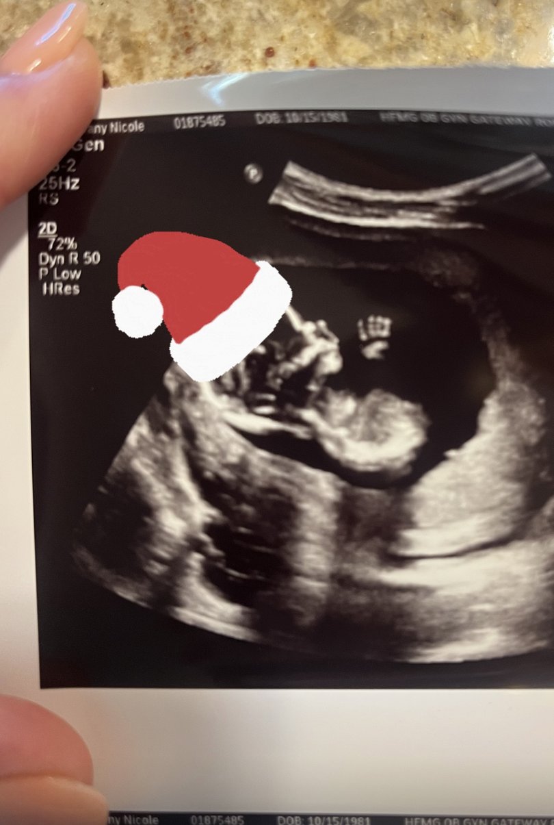 Couple welcome baby that isn’t biologically theirs.