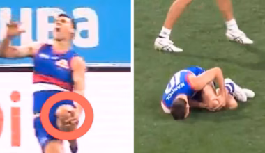 AFL star Sam Darcy suffers horrific injury in Western Bulldogs’ clash with Geelong Cats
