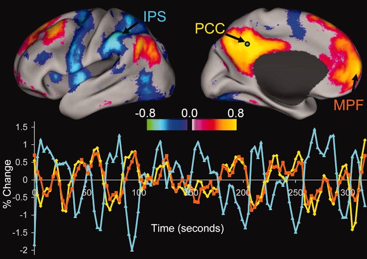 Brain scans showing variations in activity during attention-demanding cognitive tasks.