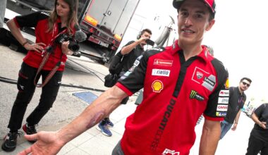 Marc Marquez shows COTA arm injury, 2026 Spanish MotoGP.