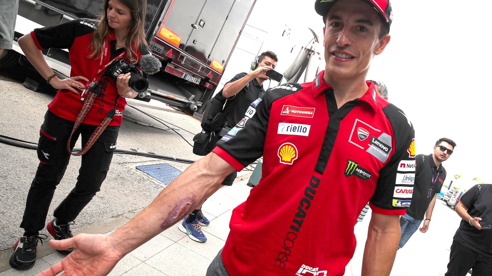 Marc Marquez shows COTA arm injury, 2026 Spanish MotoGP.