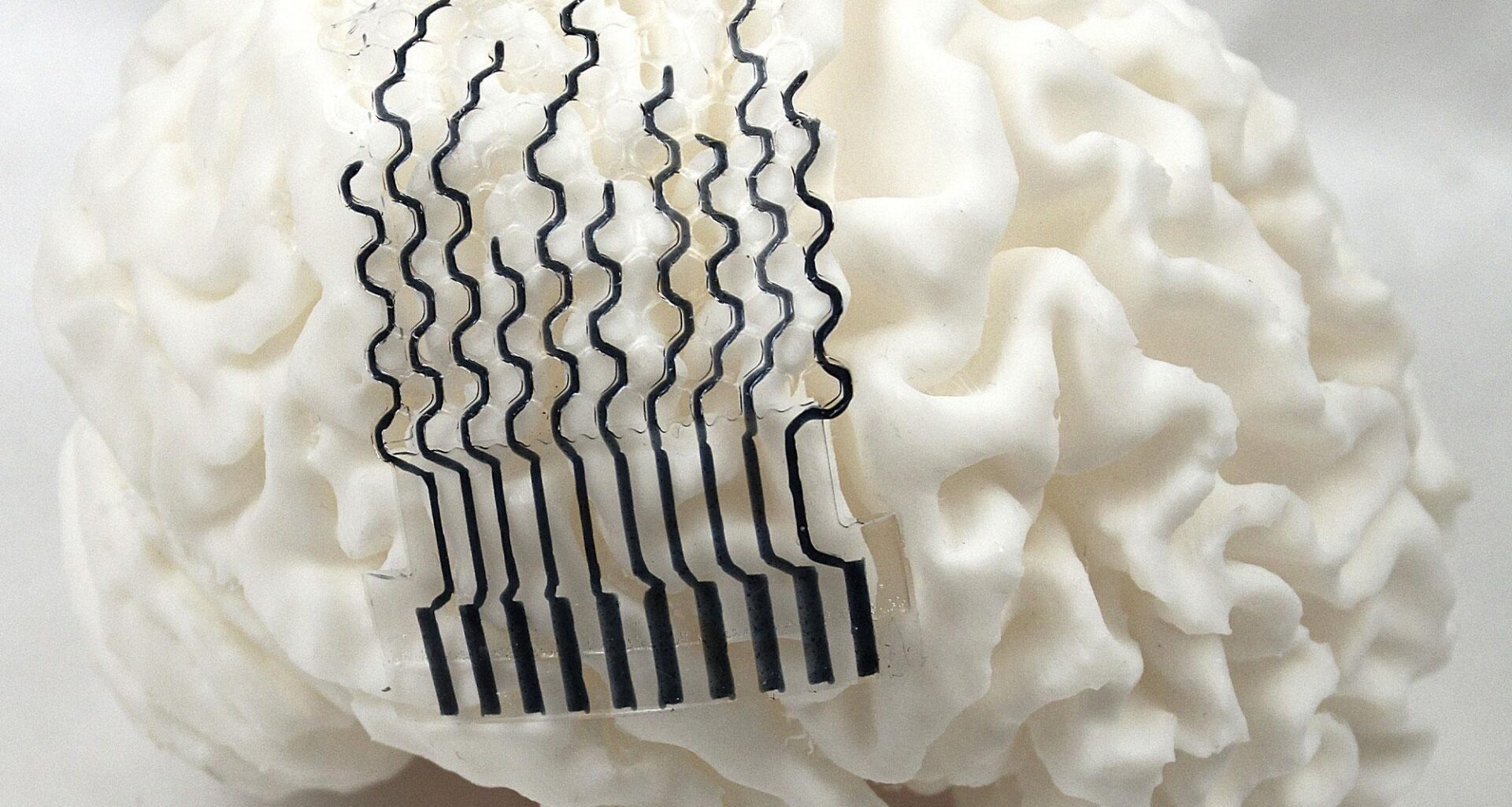 3D-Printed Brain Sensors Revolutionize Neural Monitoring