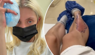 Taylor Momsen bitten by spider during mexico tour with AC/DC
