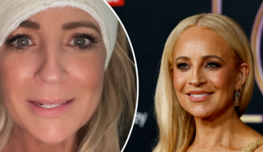 TV personality Carrie Bickmore updates fans following gruesome head injury