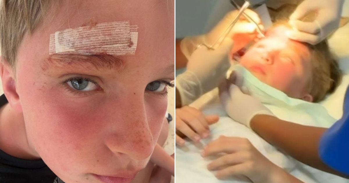 Alec and Hilaria Baldwin end up in hospital after son 'splits head open' on family holiday