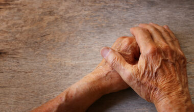 Human skin model to help treat skin stiffened by age and disease