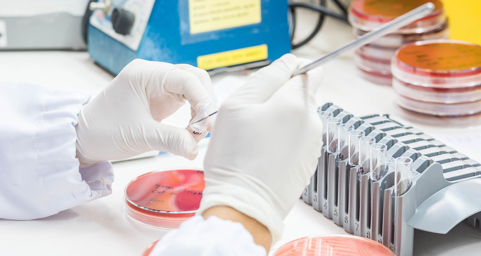 Innovative antimicrobial shows promise against resistant pathogens