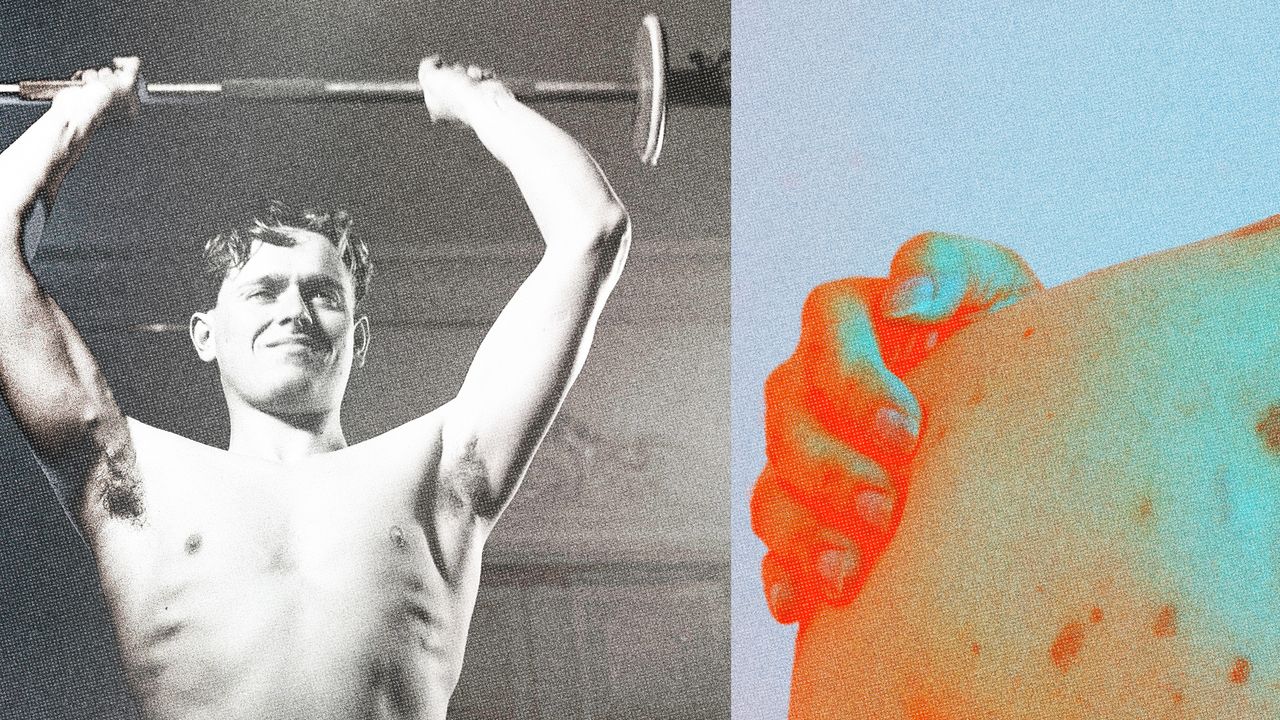 Does Working Out Help Psoriasis or Make It Worse?