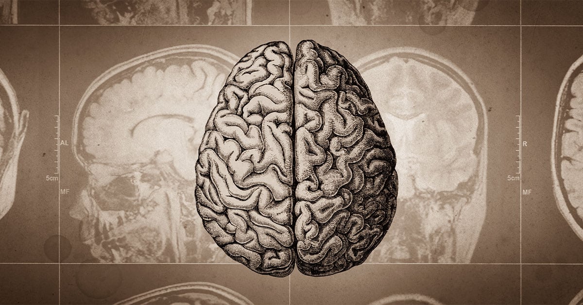 The global effort to tackle progressive MS - Updates from the International Progressive MS Alliance