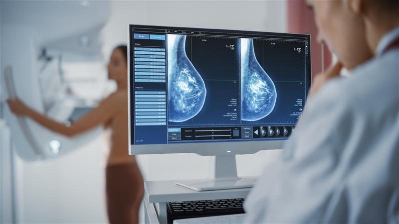 AI screening could predict the risk of breast cancer early - Featured Image