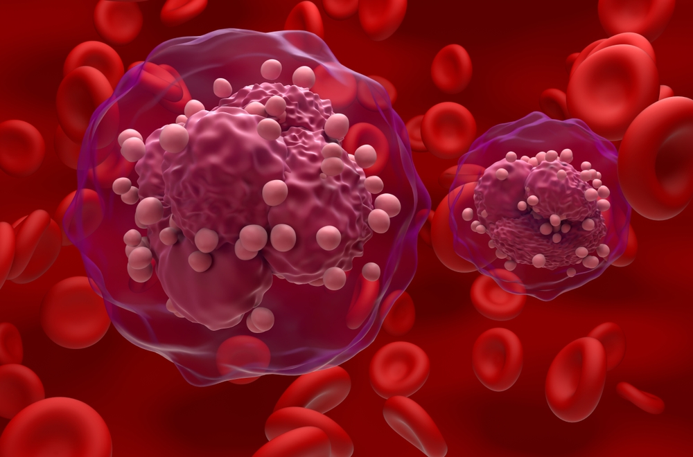 Repurposed drugs could improve treatment for rare infant leukaemia