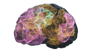 A Brain Implant for Depression Is About to Be Tested in Humans