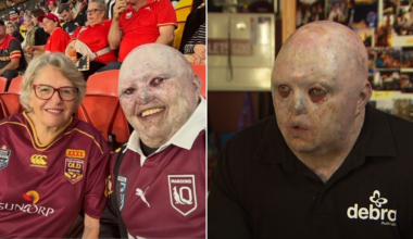 Footy fan with rare skin condition attacked online as Meta AI insults his appearance over innocent photo
