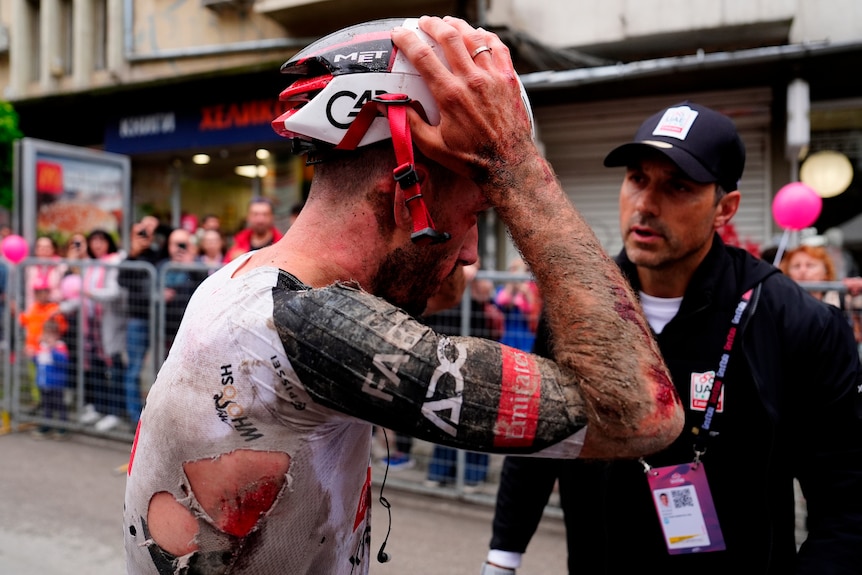 Adam Yates takes off his helmet covered in mud and blood